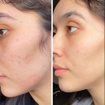 PLIX Guava Glow Brightening Skincare Combo | Vitamin C Face Serum + Juicy Cleanser | Hydrating and Glow Boosting Skin Care